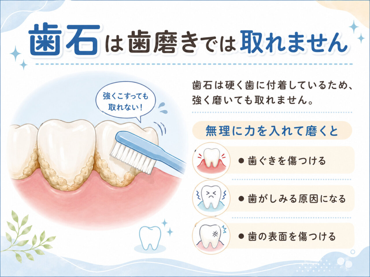 歯石は歯磨きでは取れないことを説明するイラスト
