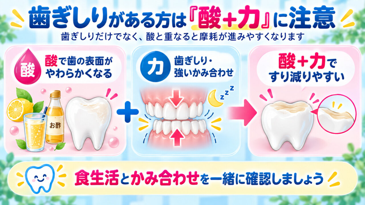 酸で弱くなった歯に歯ぎしりや強いかみ合わせが加わり歯がすり減る様子